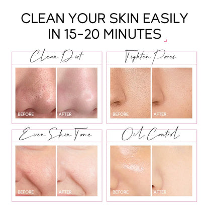 Sakura Glow 24K Gold Peel-Off Mask™